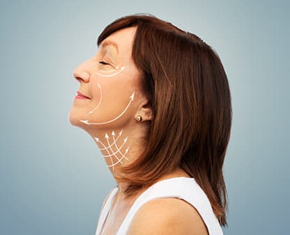 Lipotransferencia a rostro