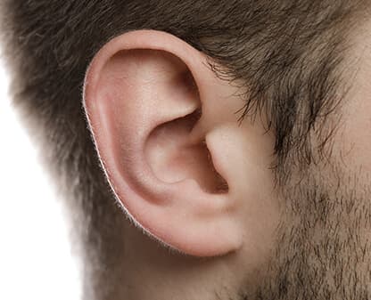 Otoplastía (cirugía de orejas)