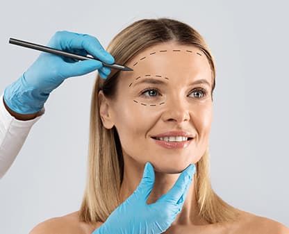 Ritidoplastía (estiramiento facial)